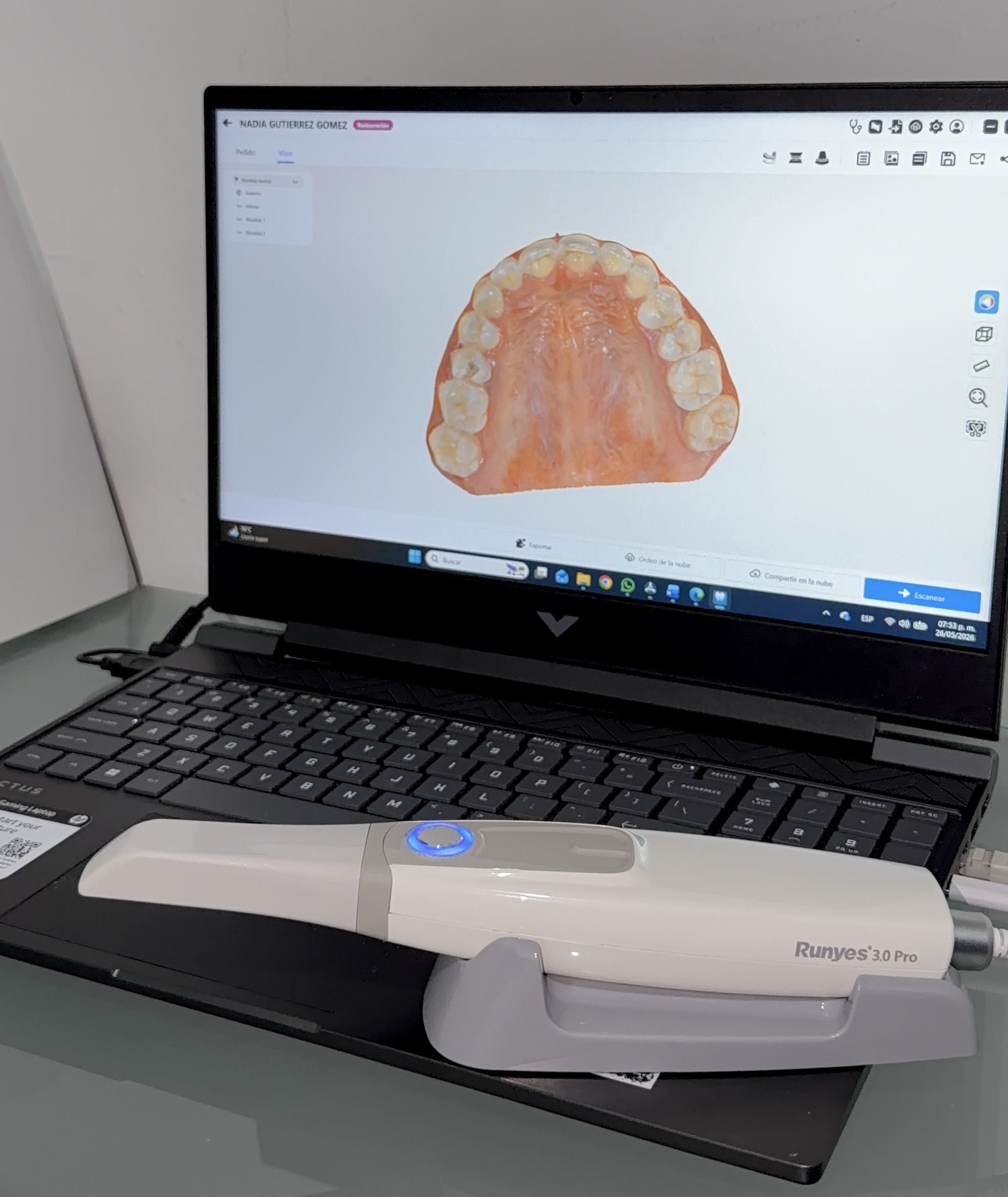 Escáner intraoral Runyes 3.0 Pro — RadioDent Pachuca